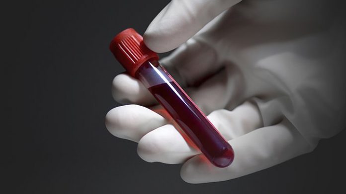 Blood test may identify gestational diabetes risk in first trimester