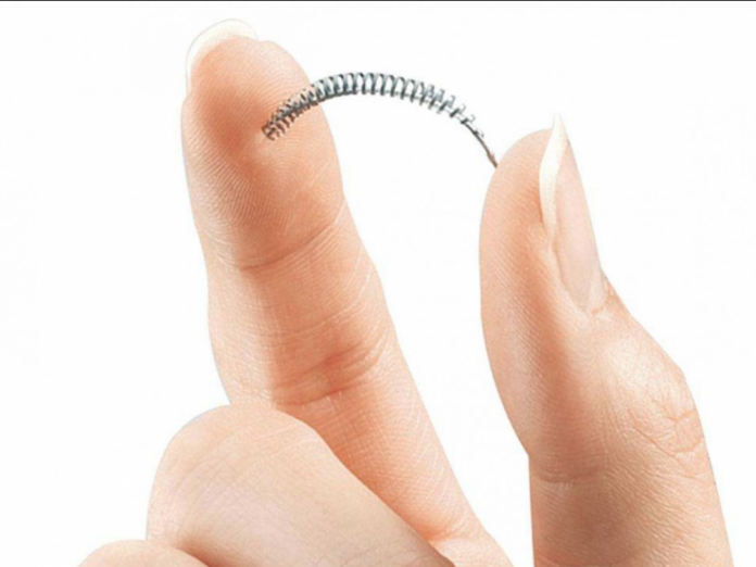 FDA Received 6,000 Reports About Essure in 2018