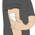 Wearable drug delivery device – unbranded