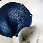 La nouvelle certification CE permettra une plus grande utilisation des dispositifs médicaux personnalisés imprimés 3D